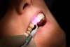 Копия Преимущества лечения зубов лазером. Показания и противопоказания к лазеротерапии и лазерной хирургии в стоматологии.